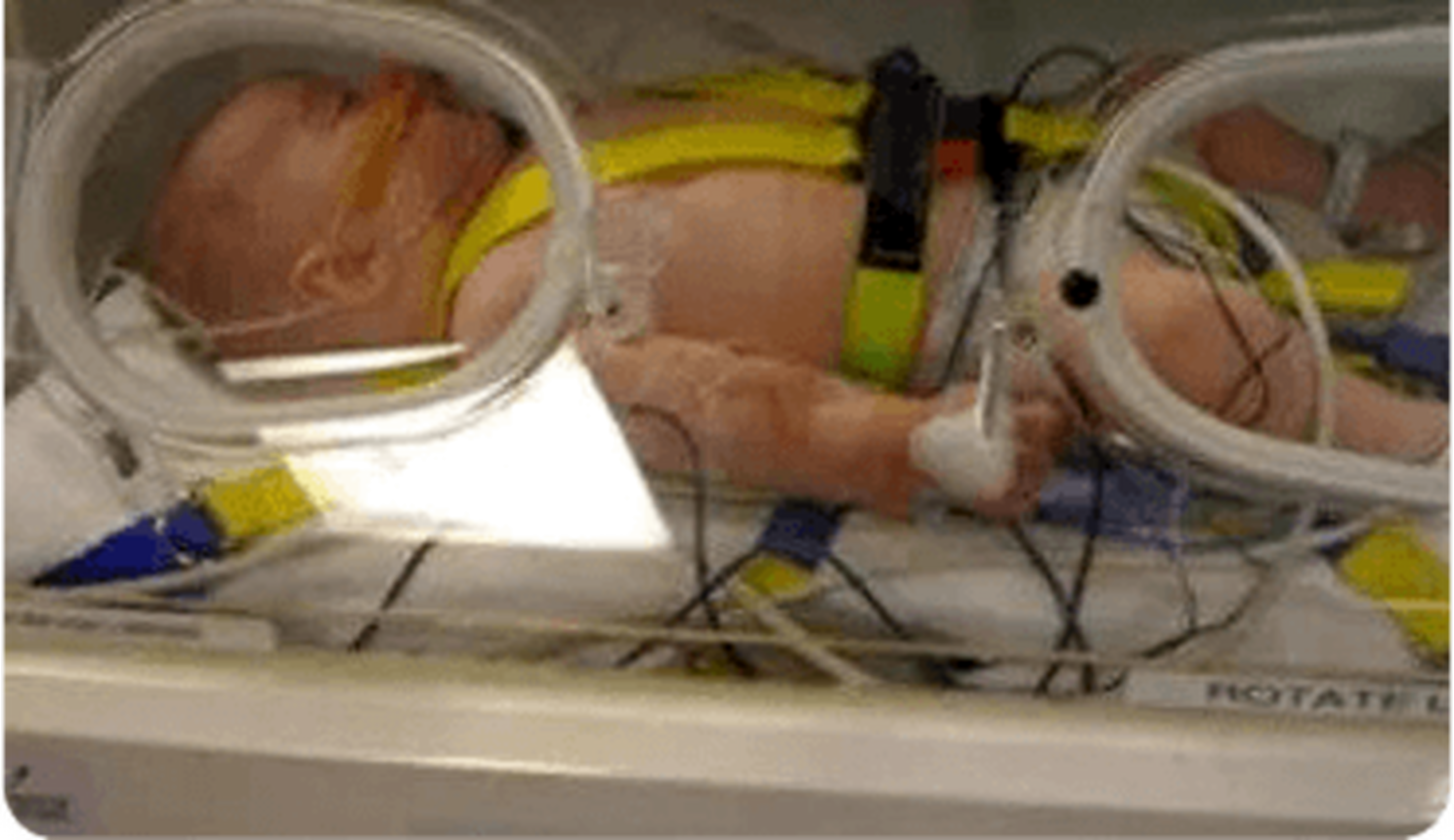 Elijah in intensive care