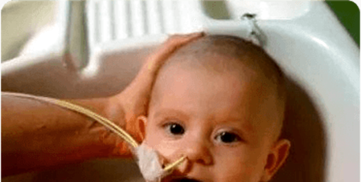 Elijah after waking from the coma